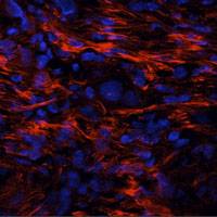 Breakthrough in cancer vaccine research