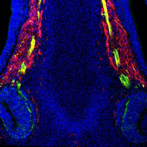 An optical section through a normal mouse nose showing the route the nerve cable