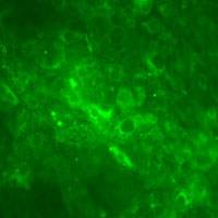 Liver cells created from patients' skin cells
