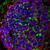 Origin of cells associated with nerve repair discovered