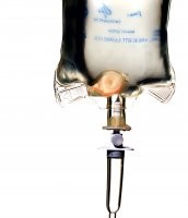 New study published in NEJM questions WHO guidelines ?