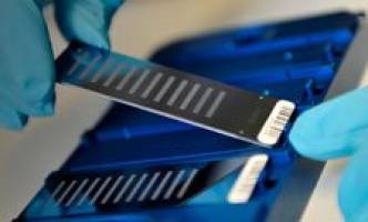 Gene for osteoporosis disorder discovered