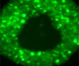 A 3D prostate tumour spheroid