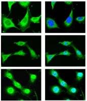 Scientists discover crucial trigger for tumour protein