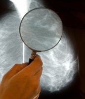 Researchers have identified a new protein involved in the development of drug re