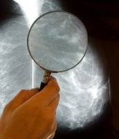 Scientists find new drug target in breast cancer