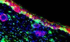 Bone marrow cells (green) can regenerate skin