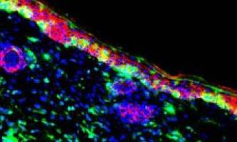 Scientists make skin repair discovery