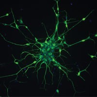 Stem cell study could aid motor neurone disease research