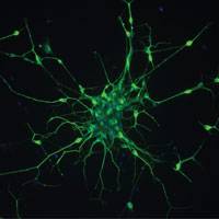 Stem cell study could aid motor neurone disease research