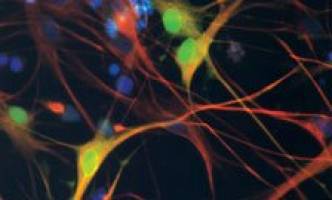 Stem cell treatment to prevent leukaemia returning is a step closer