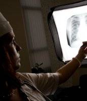 TB discovery paves the way for drugs that prevent lung destruction