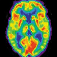 What do drugs do to the brain?