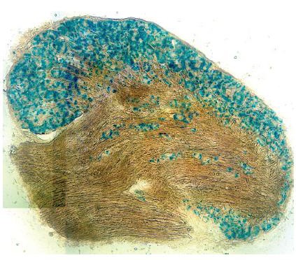 Stained dorsal route ganglion neuron  Credit : John Wood