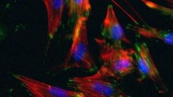 Smooth muscle cells created from patients’ skin cells