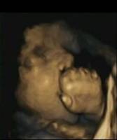 Babies learn to anticipate touch in the womb