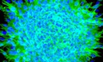 Heart's own stem cells offer hope for new treatment of heart failure