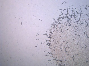 Non-parasitic worm Caenorhabditis elegans