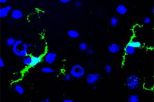 New stem cell gene therapy gives hope to prevent inherited neurological disease