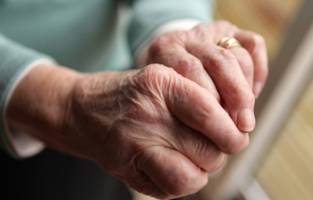 Virtual skin model reveals secrets of skin aging