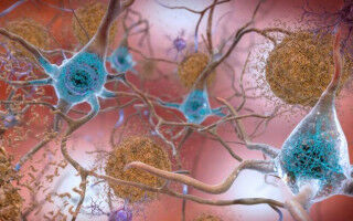 15 proteins newly linked to dementia risk