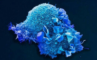Genetic changes in tumours could predict patients' immunotherapy response