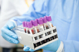 Blood test could predict future risk of leukaemia
