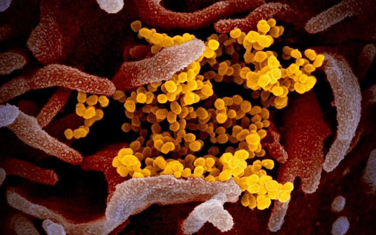 This scanning electron microscope image shows SARS-CoV-2 (yellow)--also known as