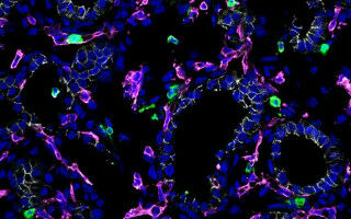 Immune cells could offer new avenues for treating respiratory diseases
