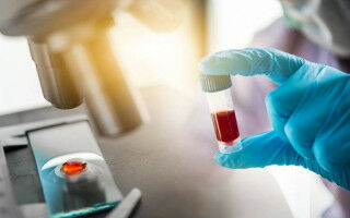 Blood test could be accurate way to detect Alzheimer's disease