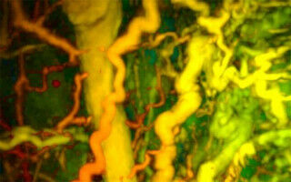 Medical imaging breakthrough could transform cancer and arthritis diagnosis