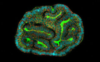 Stem cells collected in late pregnancy herald advances in prenatal medicine