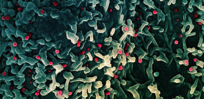 Hidden mpox exposure detected in healthy Nigerian adults, revealing under-recognised transmission