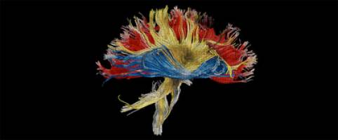 Artistic research images on display at UCL