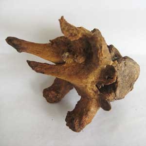top, vertebra from tuberculosis sufferer; bottom, the students carefully dismant