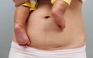 Extra one-minute check can stop some babies being born prematurely