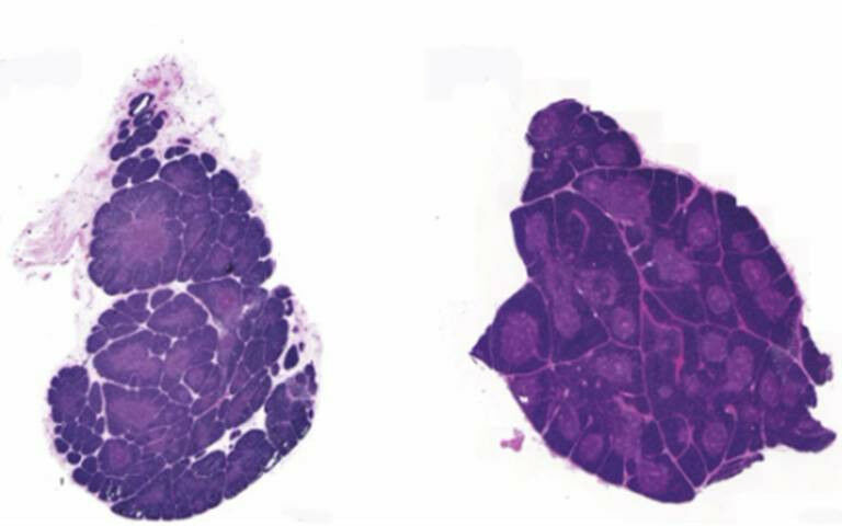 Thymus - Images of thymi�from the study.�