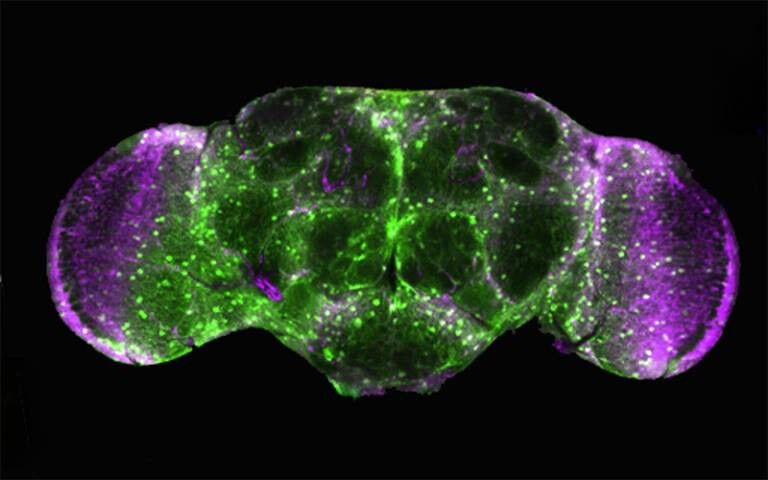 Fluorescence imaging of fly brain - Fluorescence imaging of fly brain. Credit: