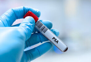 Inequalities in men with learning disabilities and prostate cancer