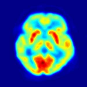 Brain image taken with positron emission tomography (PET)