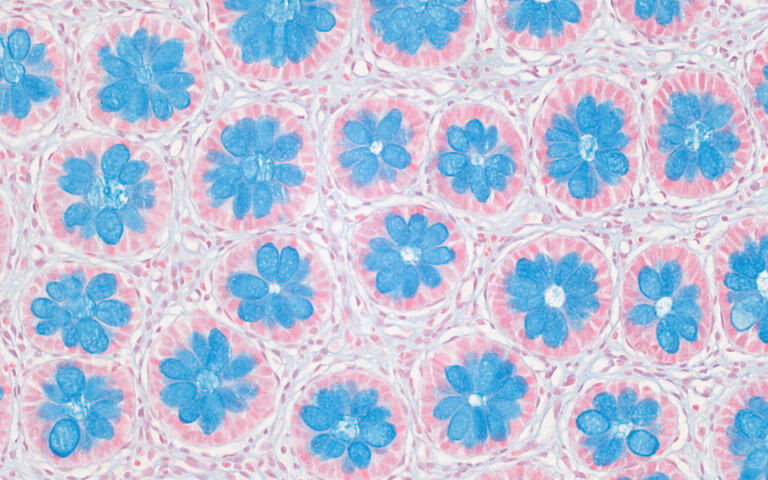 ’Blooming Barrier’ by Lucy Holland - ’Blooming Barrier’