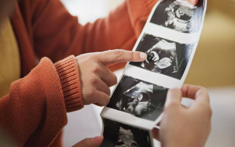 parents holding photos of baby scans