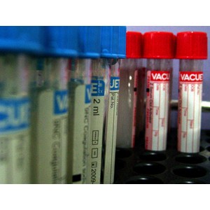 Blood samples in test tubes, by  Chandra Marsono  on Flickr
