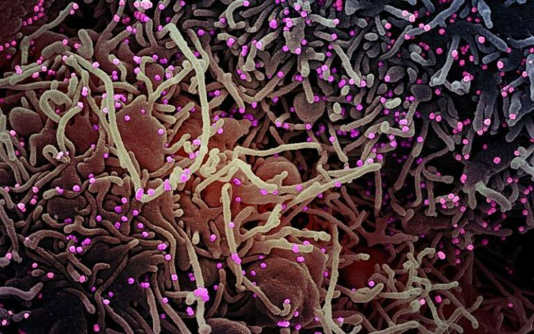 Colourised scanning electron micrograph of SARS-CoV-2: Credit NIAID - Colourised