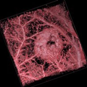 Photoacoustic image of SW1222 colorectal tumour xenograft