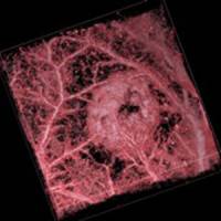 UCL prize for paper on pioneering biomedical imaging device